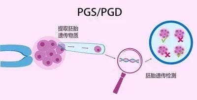 试管婴儿是否可以避免蚕豆病？