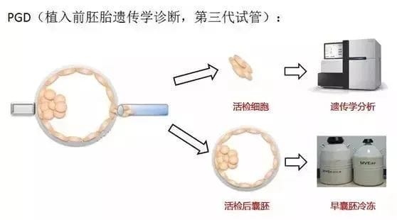 脱“染”宝宝大作战——染色体平衡易位如何健康生育?