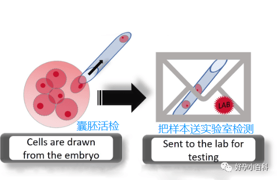 高龄备孕，该如何避免染色体问题导致的胎停流产？