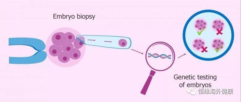 【好孕科普】告诉你，胚胎染色体异常的所有真相！