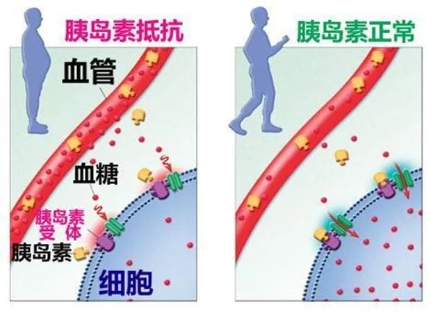 0%多囊姐妹容易忽略的点，但却是导致流产的"真凶"之一！"