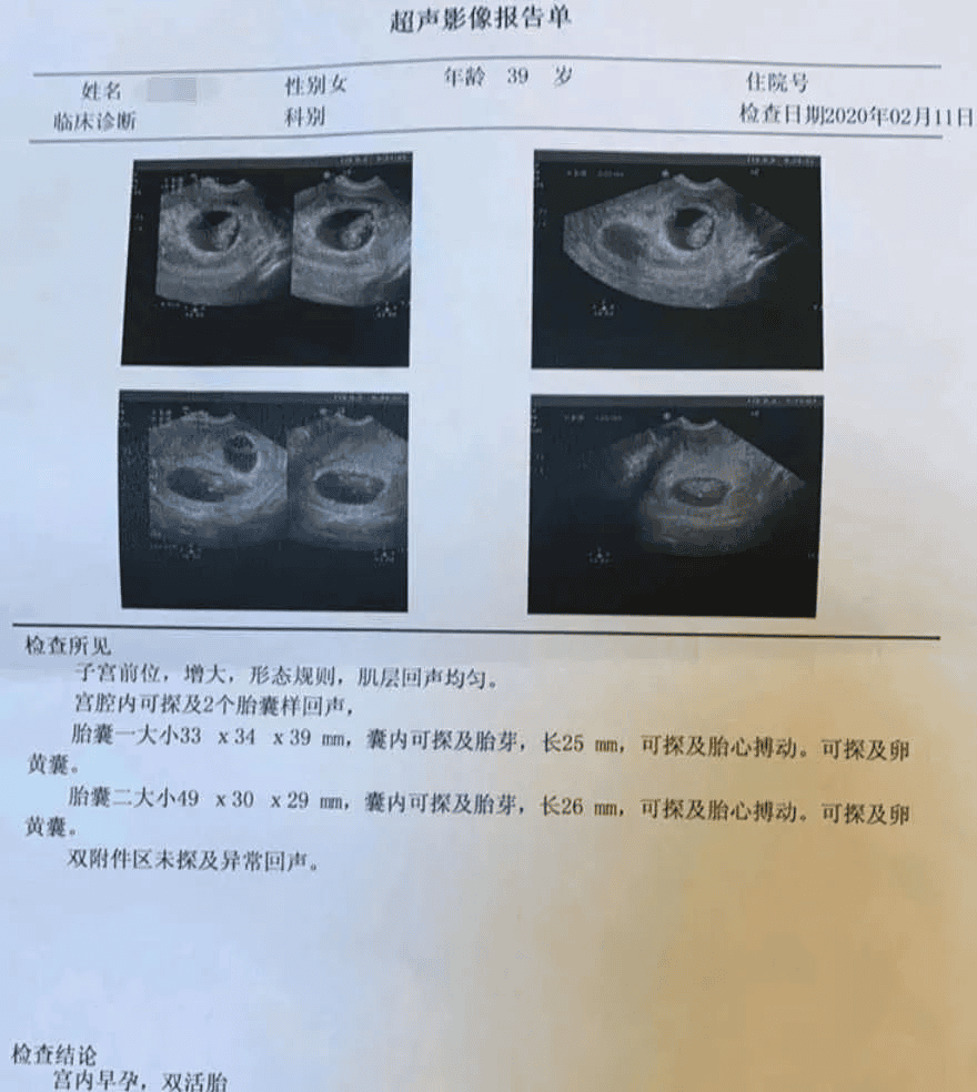 好孕百科  |  不要小看引发不孕的子宫“多肉”