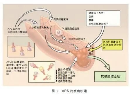 做试管前是否有必要检查「自身免疫抗体」?