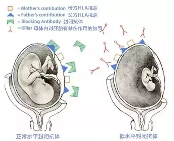 反复流产、难以受孕、试管婴儿屡次失败......居然与这个因素异常有关！