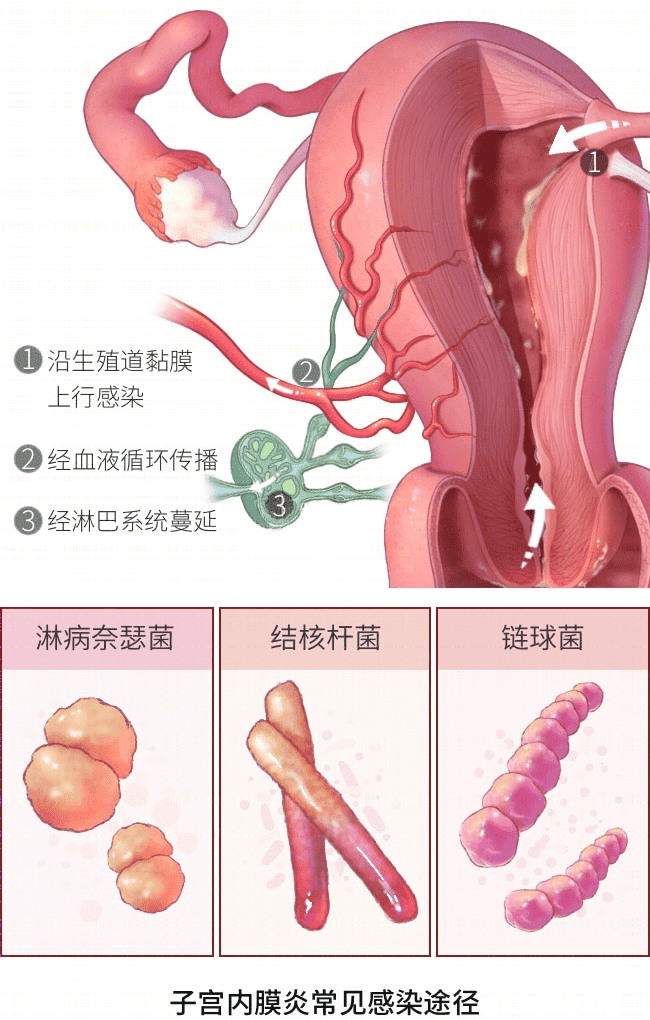 月经量少=卵巢早衰？别自己吓自己了