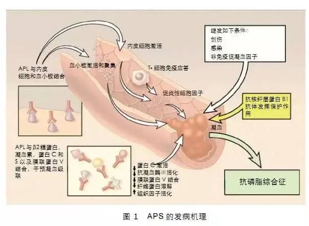 反复流产的“元凶”之一居然是“它”！