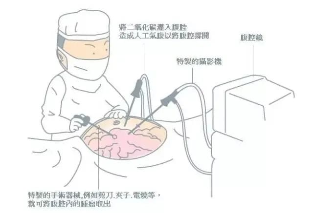 经常痛经难忍?有可能是子宫内膜异位症在作怪！