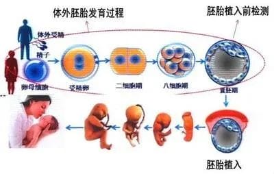 经常痛经难忍?有可能是子宫内膜异位症在作怪！