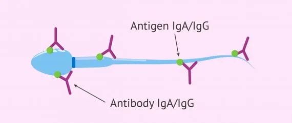 抗精子抗体阳性可以做试管婴儿助孕吗?