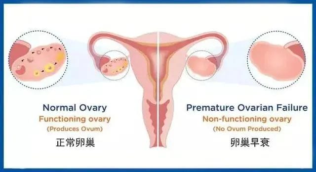 不得不知的卵巢早衰3个征兆和预防措施！