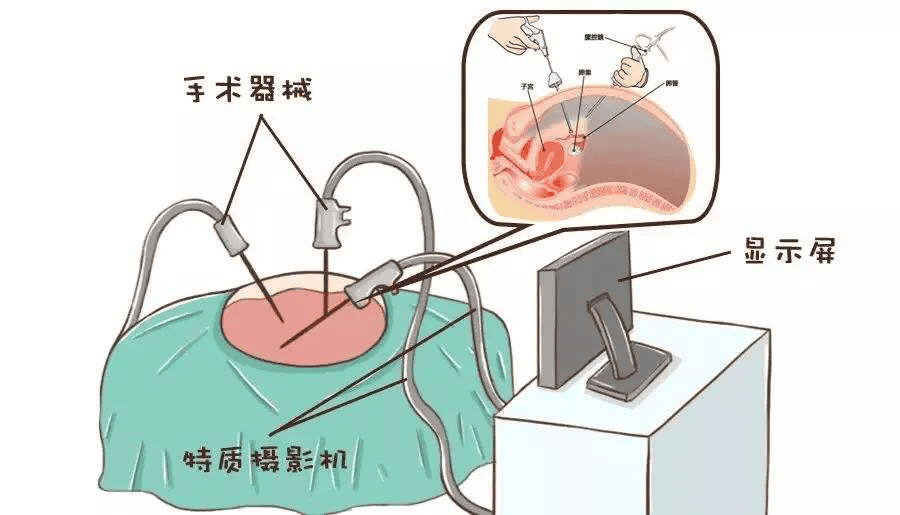 试管知识 | 好“孕”迟到或许和这个因素也有关！