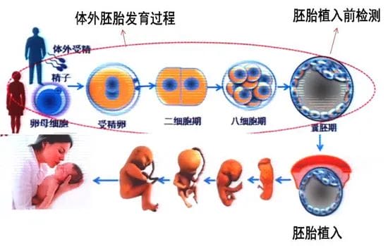 单基因遗传病可预防？这事儿是真的！