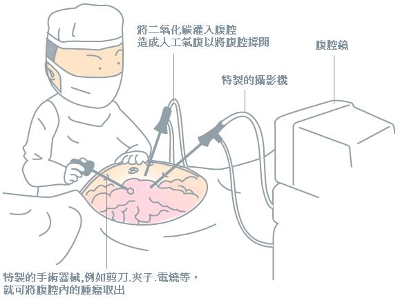 不孕的原因千万种，最基本的原来是这一个！