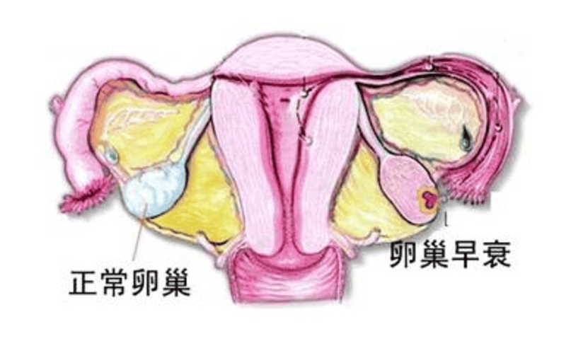 盘点做试管前必须做的检查——性激素六项！