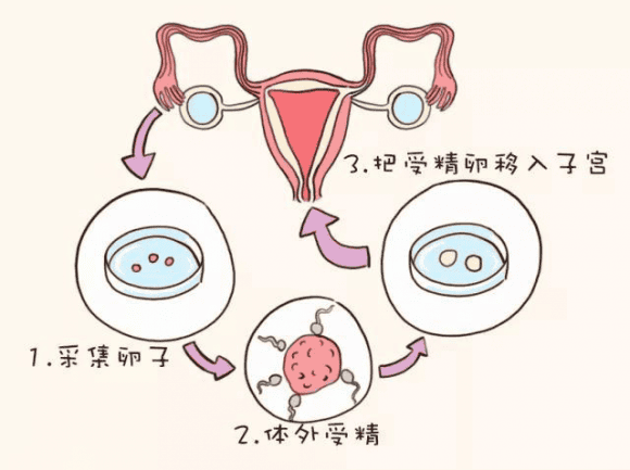 深度揭秘，试管婴儿必须做的性激素六项到底是指什么？