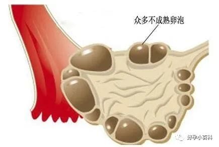 试管婴儿，为什么一定要经期检查窦卵泡？