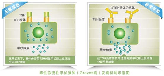 科学备孕，促甲状腺激素不达标......