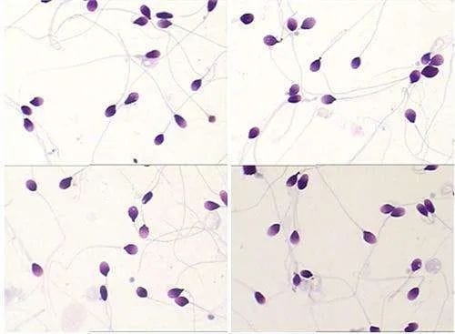干货  |  精子"碎"了，该如何成就"爸"业！