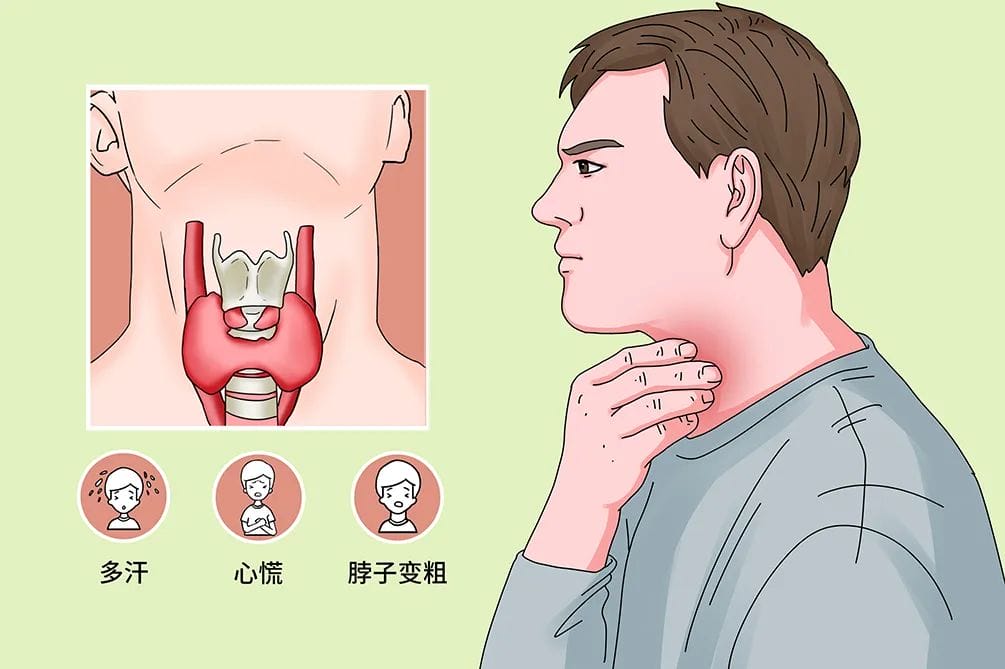 做试管前为什么一定要查甲状腺功能？