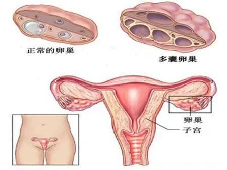 做试管前为什么一定要查甲状腺功能？