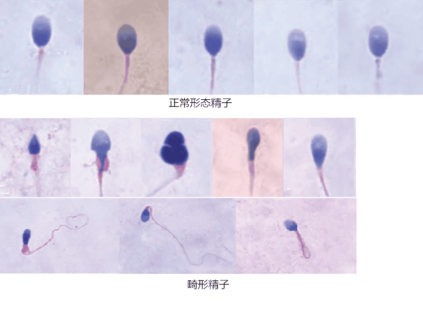 精液检查都查了啥？一分钟教你看懂精液分析报告