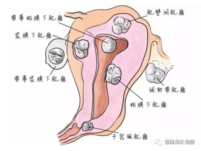 试管婴儿那些事，我不要你觉得，我要我觉得！