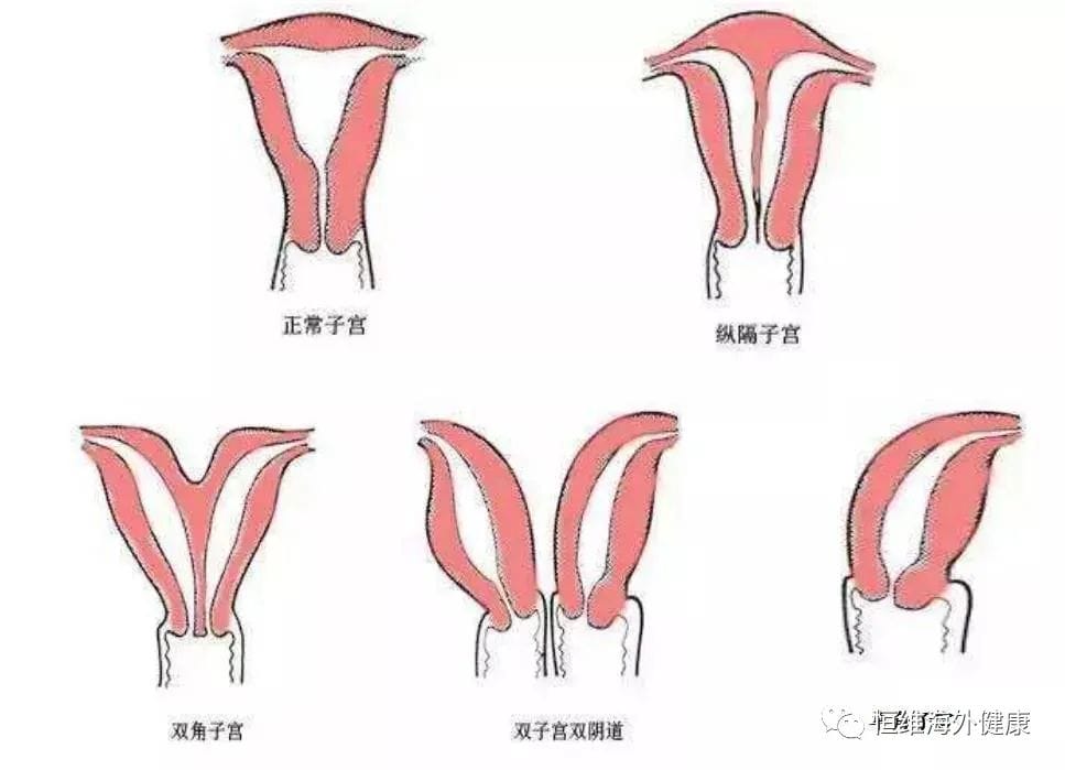 试管婴儿那些事，我不要你觉得，我要我觉得！