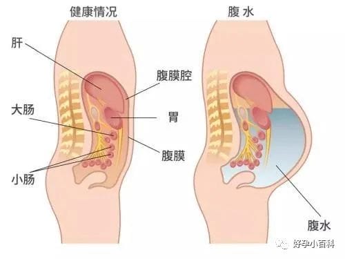 .8万被忽悠，不如好好了解这些试管婴儿知识"