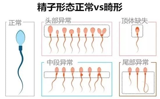 想要胚胎健康发育，精子质量不能忽视！