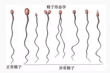 为精子"加油"的助孕好"帮手"，你get到了吗?