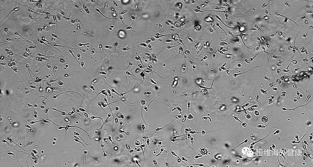 男性生育力大幅度下降，少精、弱精、无精的生育“男”题该怎么解？
