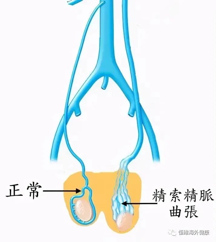 和弱精症说“再见”！用试管婴儿一招搞定弱精“男题”