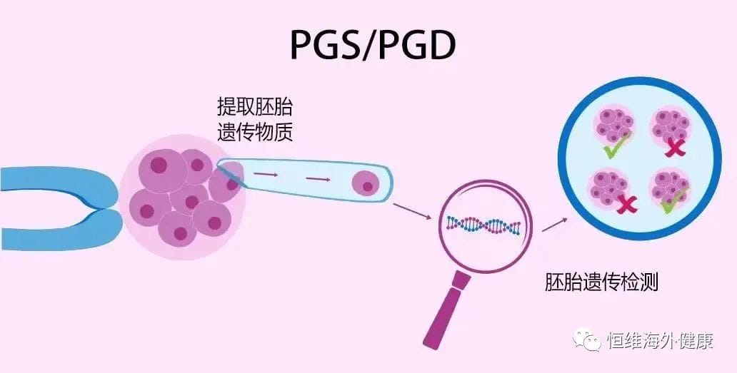 和弱精症说“再见”！用试管婴儿一招搞定弱精“男题”