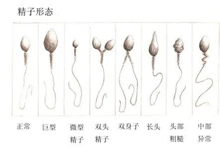 有的人年纪轻轻，精子却“不行”了