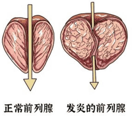 有的人年纪轻轻，精子却“不行”了