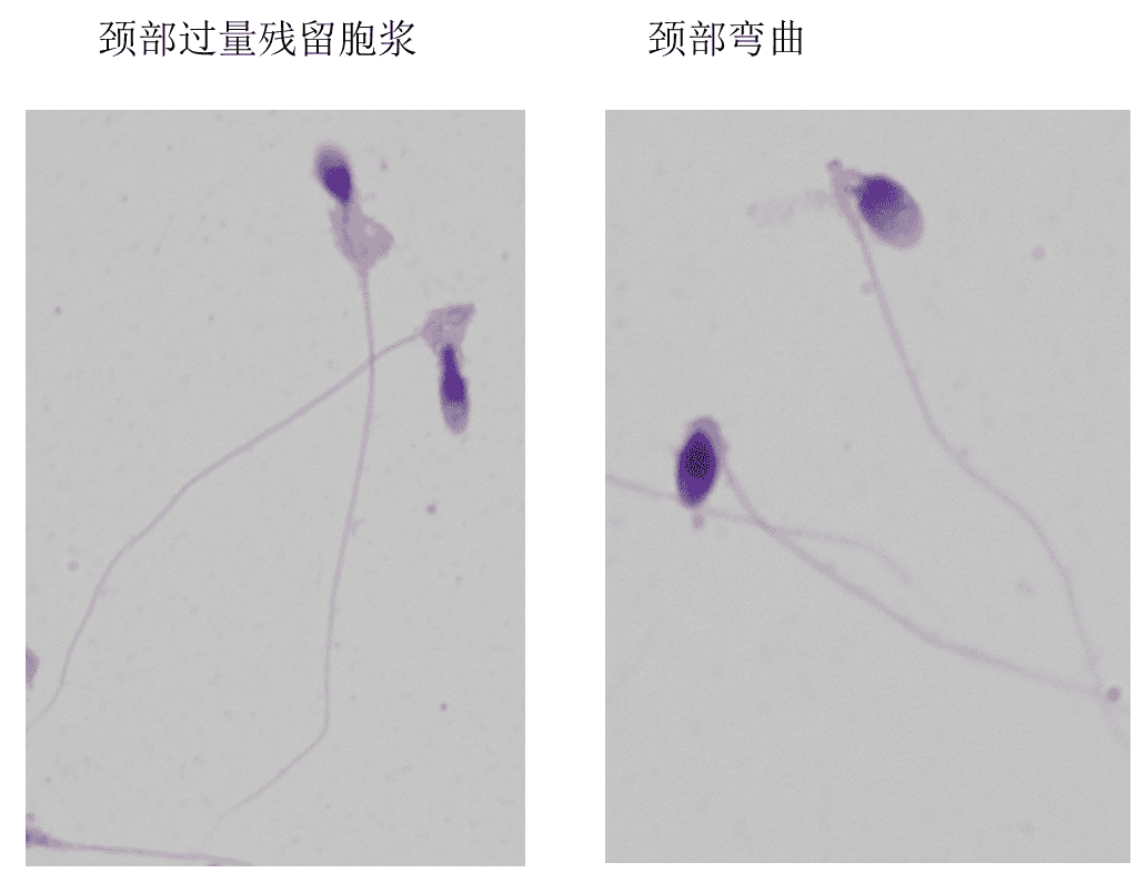 「颜值」鉴赏大会，一起看看「顶流」级别的精子长啥样！