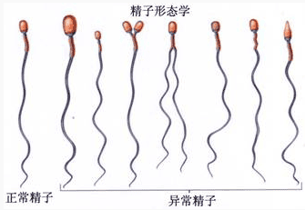 颗精子4颗不合格，是谁“偷”走了男性生育力?"