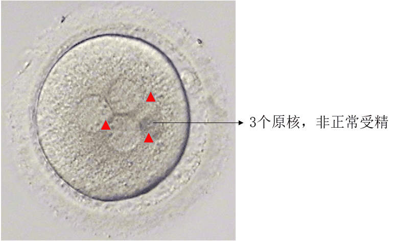 论“以貌取人”这方面还得看我们的胚胎！