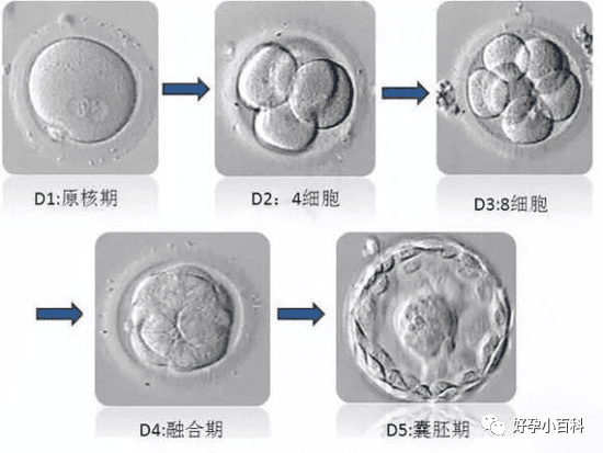 颜值即正义，选对象是，选胚胎也是！！