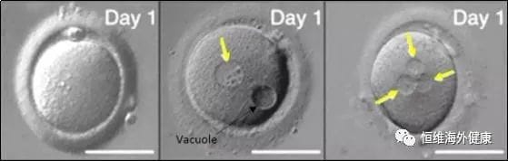 试管冷知识 | 为什么我的卵子这么多，却只配成几个胚胎？