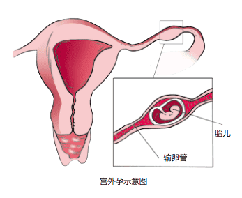 鲜胚VS冻胚 试管婴儿移植哪种胚胎成功率更高？