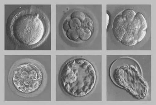 养囊的3大理由！让你不再纠结是否选择囊胚培养