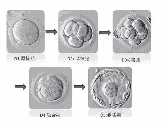 试管婴儿「一击即中」​的秘诀——胚胎质量！