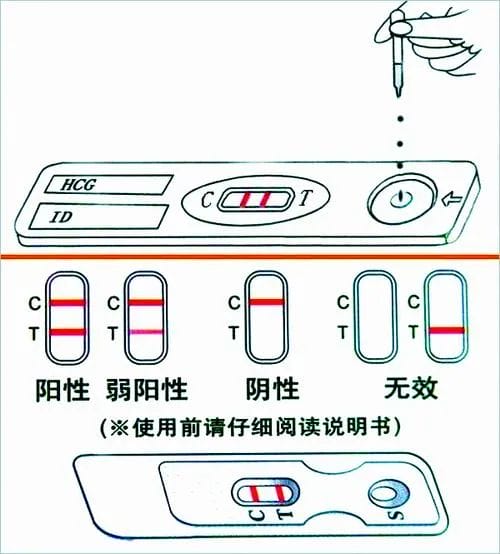 移植后，验尿VS验血，哪个比较好?