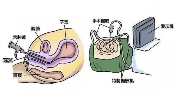 导致试管不着床的8个原因你中了吗?