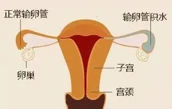 导致试管不着床的8个原因你中了吗?