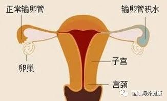 反复移植失败与试管之间的"爱恨纠缠"！