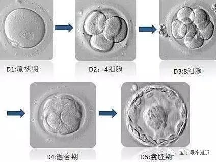 反复移植失败与试管之间的"爱恨纠缠"！