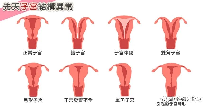 导致胎停流产的6个因素，孕早期该如何预防避免?