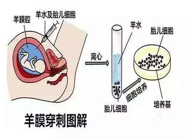 出现胎心胎芽还会胎停?这几个高危因素不可忽视！